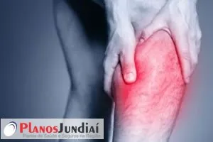 Cãibras, suas causas e tratamento Cãibras, suas causas e tratamento