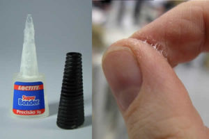 Como tirar Super Bonder da pele