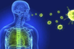 Detalhes sobre a Pneumonia